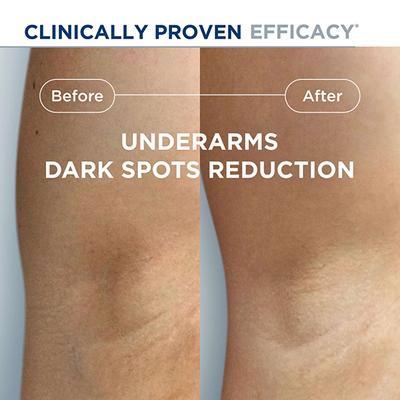 Bioderma Pigmentbio Sensitive Areas Cream 75 ml - Face Creams