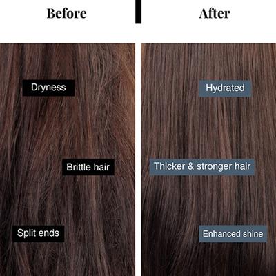 Bare Anatomy Anti Hair Fall Shampoo 5X Hair Fall Control Sulphate & Paraben Free 250 ml - Shampoos