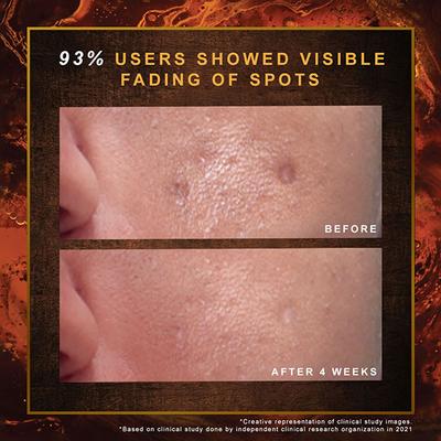 Indulekha Ayurvedic Proprietary Medicine Soap 100gm Each Bar, 300gm Packs 3's - Soaps