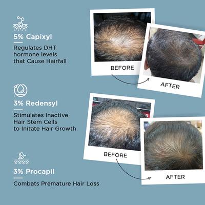 Kaya Regenerist Hair Serum For Regrowth Suitable For Men & Women 50 ml - Hair Serums