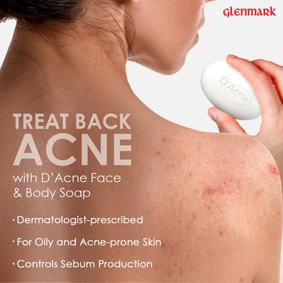 D Acne Soap 75gm - Soaps