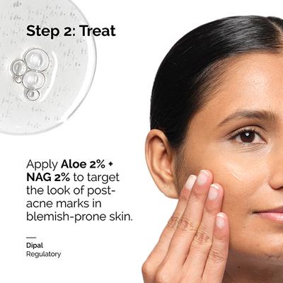 The Ordinary Aloe 2% + NAG 2% Solution (INT) 30 ml - Face Serum