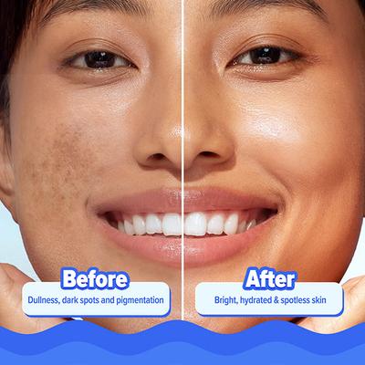 Aqualogica Bright+ Hydra Gel Moisturizer with Blueberry & Kojic Acid 200 gm - Face Moisturizers