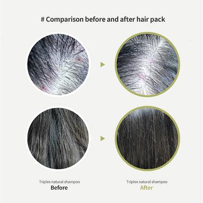 Lador Tea Tree Scalp Clinic Hair Pack 200 ml - Hair Masks & Packs