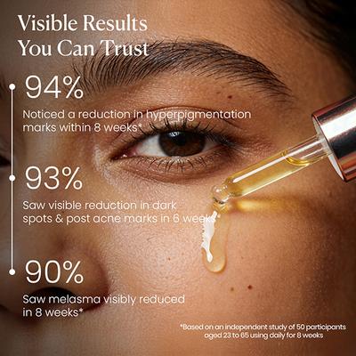 Bie - Beauty In Everything Zero Dark Spot Corrector & Anti-Pigmentation Serum 30 ml - Face Serum