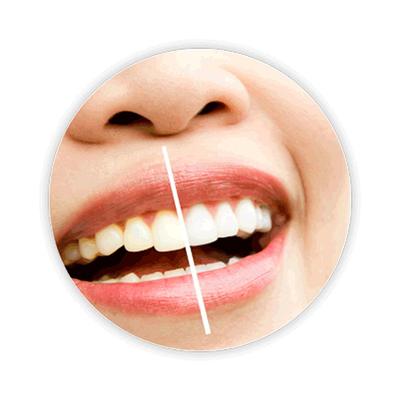 Bonayu Teeth Whitening Strips and Teeth Sensitivity Strips 50G 60's - Mouthwash