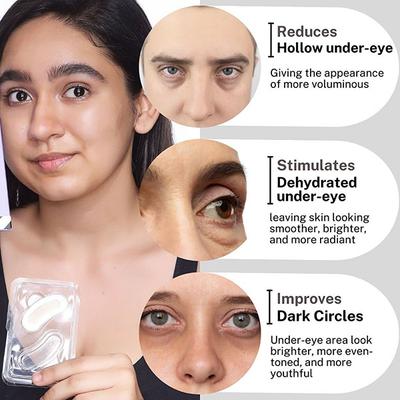 House of Beauty Instant Filler Hyaluronic Undereye Patches For Dark Circles & Plumping (2 Pairs) 2's - Dark Circle & Wrinkle Busters