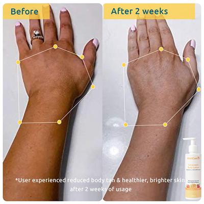 WishCare Head to Toe Sun Protection Kit with SPF 50 Niacinamide Oil Ceramide Lip Balm , SPF 50 PA+++ 1's - Face Sunscreen