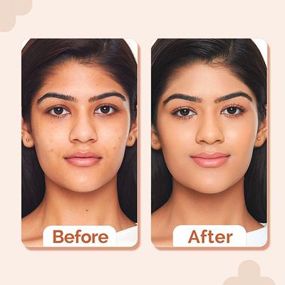 The Derma Co. 2% Niacinamide High Coverage Foundation,1% Hyaluronic Acid and SPF 40 PA+++ for 12 Hr- 05 Peach 30 gm - Foundation