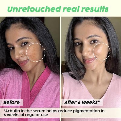 Plix The Plant Fix 5% Pineapple Foaming Facewash For Depigmentation, Unisex 100 ml - Face Wash & Cleansers