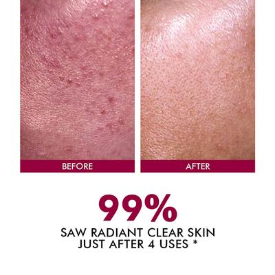 Conscious Chemist Advanced Resurfacing Peeling Solution 25% AHA + 2% BHA + 5% PHA Exfoliating Facial Serum 30 ml - Face Serum