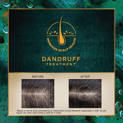 Indulekha Svetakutaja Oil Ayurvedic Medicinal Oil For Dandruff Treatment 100% Ayurvedic Oil 100 ml - Hair Oils