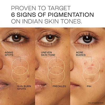 Lakme Absolute Perfect Radiance Skin Brightening Day Creme 28 Gm - Face Creams