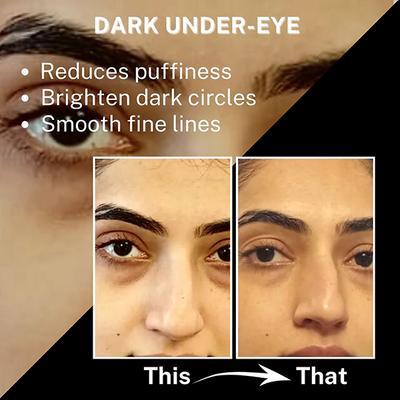 House of Beauty Under Eye Cream For Dark Circles, Fine Lines & Hydrating with Hyaluronic 30ml - Under Eye Creams & Serums