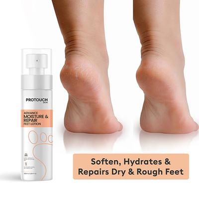 Protouch Advance Moisture and Repair Feet Lotion, Deeply Hydrating and Moisturizing Lotion Spray 100 ml - Foot Creams & Lotions