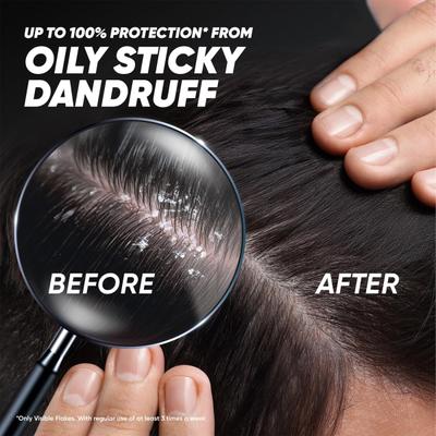 Head & Shoulders Oily Sticky Dandruff Deep Cleanse With Oxygenated Charcoal Shampoo 340 ml - Shampoos