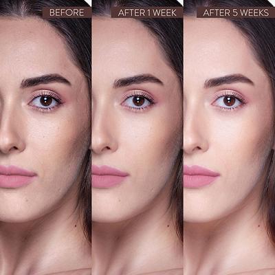 Belora Paris Serum 24k Gold Advanced ++ (Serum 24 Carats Avance) 30 ml - Face Gels