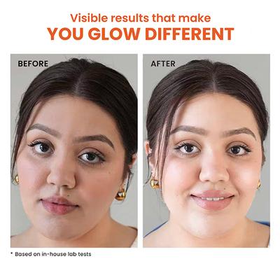 Foxtale Essentials Brightening Spf 50 Sunscreen with Vitamin C and Niacinamide 50 ml - Face Sunscreen