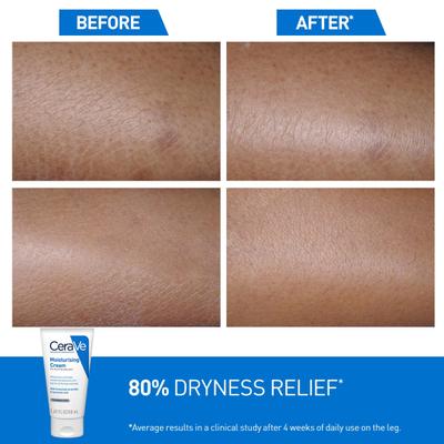 CeraVe Moisturising Cream For Dry To Very Dry Skin 50 ml - Lotions & Creams