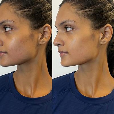 House of Beauty Led Red Light Eye Massager- Hollow Undereyes, Dark Circles, Boosts Collagen 1's - Massagers