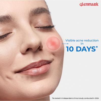 D Acne Foaming Face Wash Foam 60ml - Face Wash & Cleansers