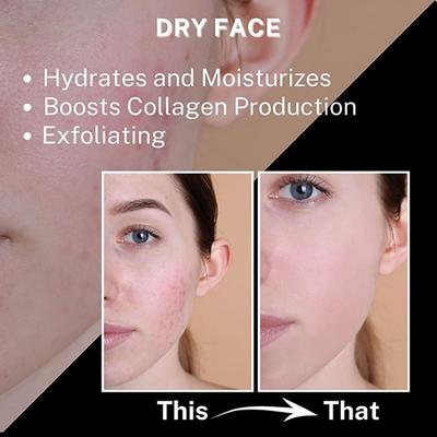 House of Beauty Hibiscus Oil For Hairfall, Soft Skin, Aids Psoriasis For Body & Hair 200ml - Hair Oils