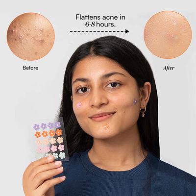 Gush Beauty Dart It Hydrocolloid Pimple Patches For Healing Acne, Zits And Blemishes - Heart 1's - Masks & Peels