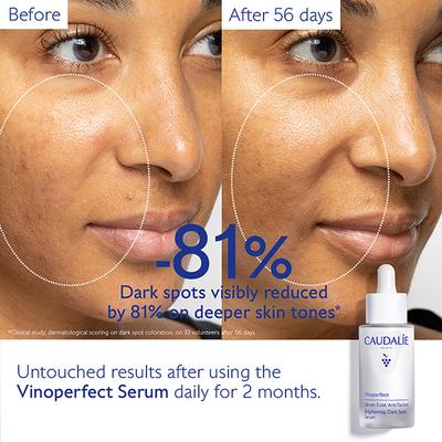 Caudalie Vinoperfect Brightening Dark Spot Serum 30 ml - Face Gels