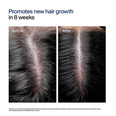 Wishcare Hair Growth Serum Concentrate with Redensyl - In-Vivo Tested-Boosts Hair Growth (100ml) - Hair Combs