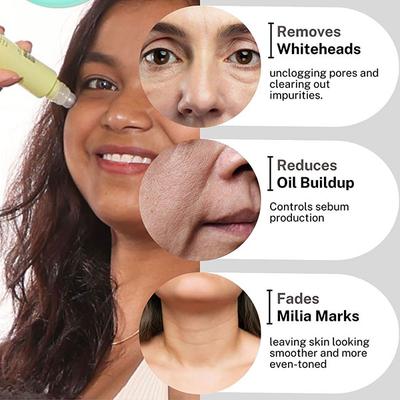 House of Beauty Milia Serum For White Cysts, Black & Whiteheads, Open Pores with Azelaic 15ml - Face Serum