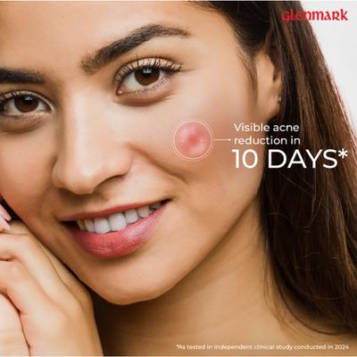 D Acne Soft Face Wash 100gm - Face Wash & Cleansers