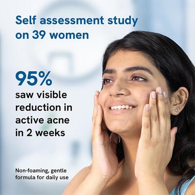 Be Bodywise 2.5% Benzoyl Peroxide Face Wash 100 ml - Face Wash & Cleansers