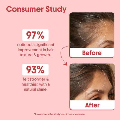 Aravi Organic Batana Hair Oil for Hair Growth with Pumpkin Oil - Derived from American Oil Palm Nut 200 ml - Hair Oils