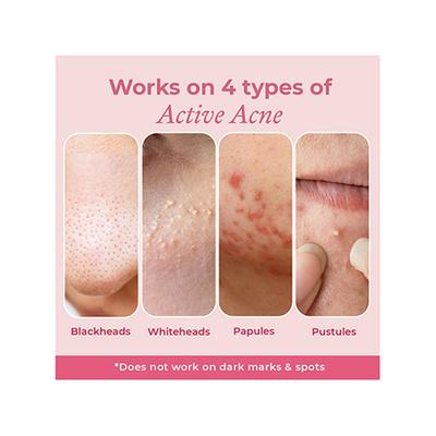 The Pink Foundry Overnight Acne Spot Corrector 30 ml - Skin-Treatment