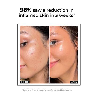 Conscious Chemist Snail Magic Skin Barrier Repair All In One Cream 50 gm - Face Moisturizers