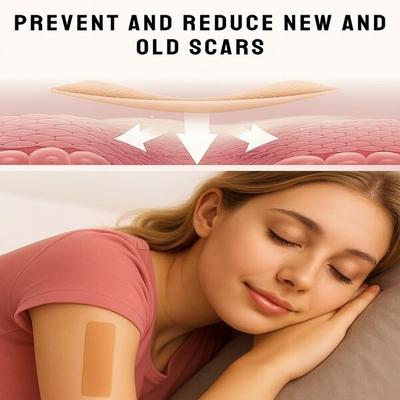 Scarxgen Silicone Gel Sheet (4cm x 150cm) 1 's - Bandages