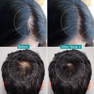 Pilgrim 3% Redensyl and 4% Anagain Advanced Hair Growth Serum 100 ml - Hair Serums