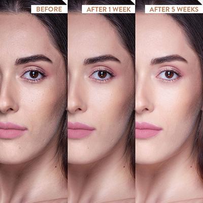 Belora Paris 5 - in -1 Black tea better skin moisturizer 50 gm - Face Moisturizers