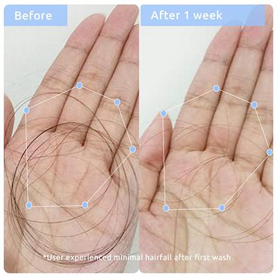 WishCare Anti Hairfall Kit- with Anti Hairfall Shampoo & Conditioner Concentrate for Hair Growth 480ml 1's - Hair Serums