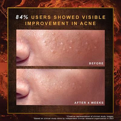 Indulekha Ayurvedic Proprietary Medicine Soap 100gm Each Bar, 300gm Packs 3's - Soaps