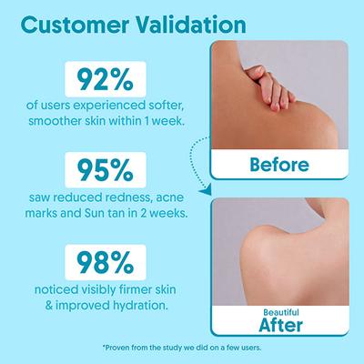 Aravi Organic 2% Salicylic Acid Exfoliating Body Wash With Niacinamide - Prevents Back & Body Acne 300 ml - Shower Gels & Body Wash