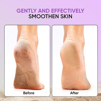 Vega 4-In-1 Pedicure Foot Scrubber For Dead Skin, Callus & Cracked Heels Removal, (Pd-02N) - Manicure & Pedicure Kits