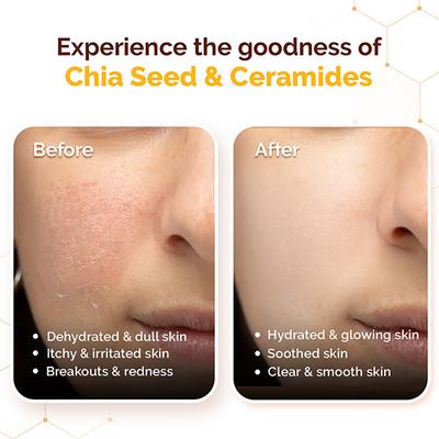 Mamaearth Chia Calming Sunscreen with Chia Seed & Ceramides 50 g - Face Sunscreen