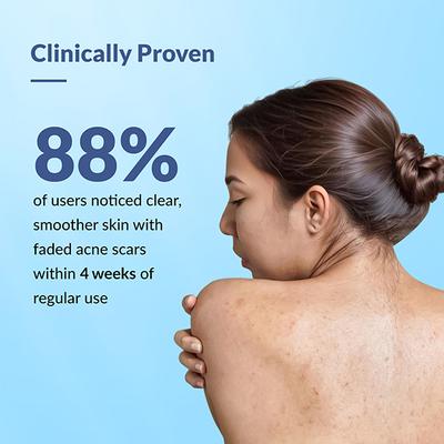 Fixderma Salyzap Acne Body Wash 200 ml - Face Gels