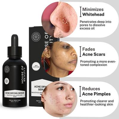 House of Beauty Acne Drying Serum For Pimpled, Oily & Open Pores Skin with Salicylic Acid 30ml - Face Serum