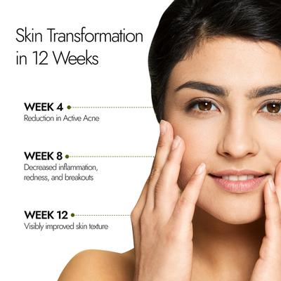 Kapiva Skin Foods Acne Ease Fizz Tablet 20's - Skin-Treatment