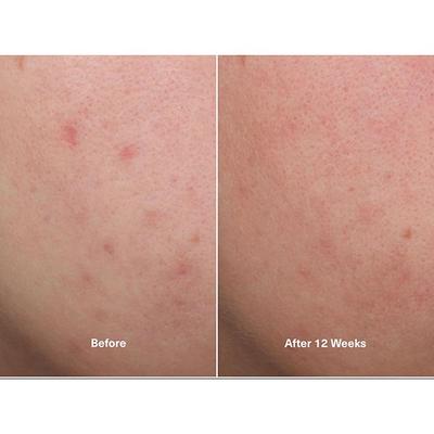 La Mer The Concentrate 30 ml - Face Gels