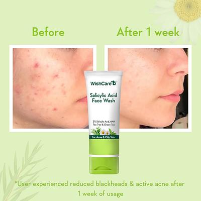 WishCare 2% Salicylic Acid Face Wash with AHA GreenTea Chamomile & TeaTree - For Oil & Acne Control 100 ml - Face Washes
