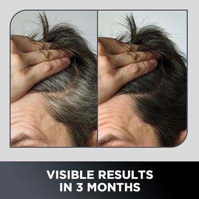 The Man Company Anti-Graying 2-In-1 Formula Shampoo & Conditioner 200ml - Shampoos