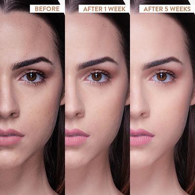 Belora Paris Pumpkin spice anti ageing moisturizer 50 gm - Face Moisturizers